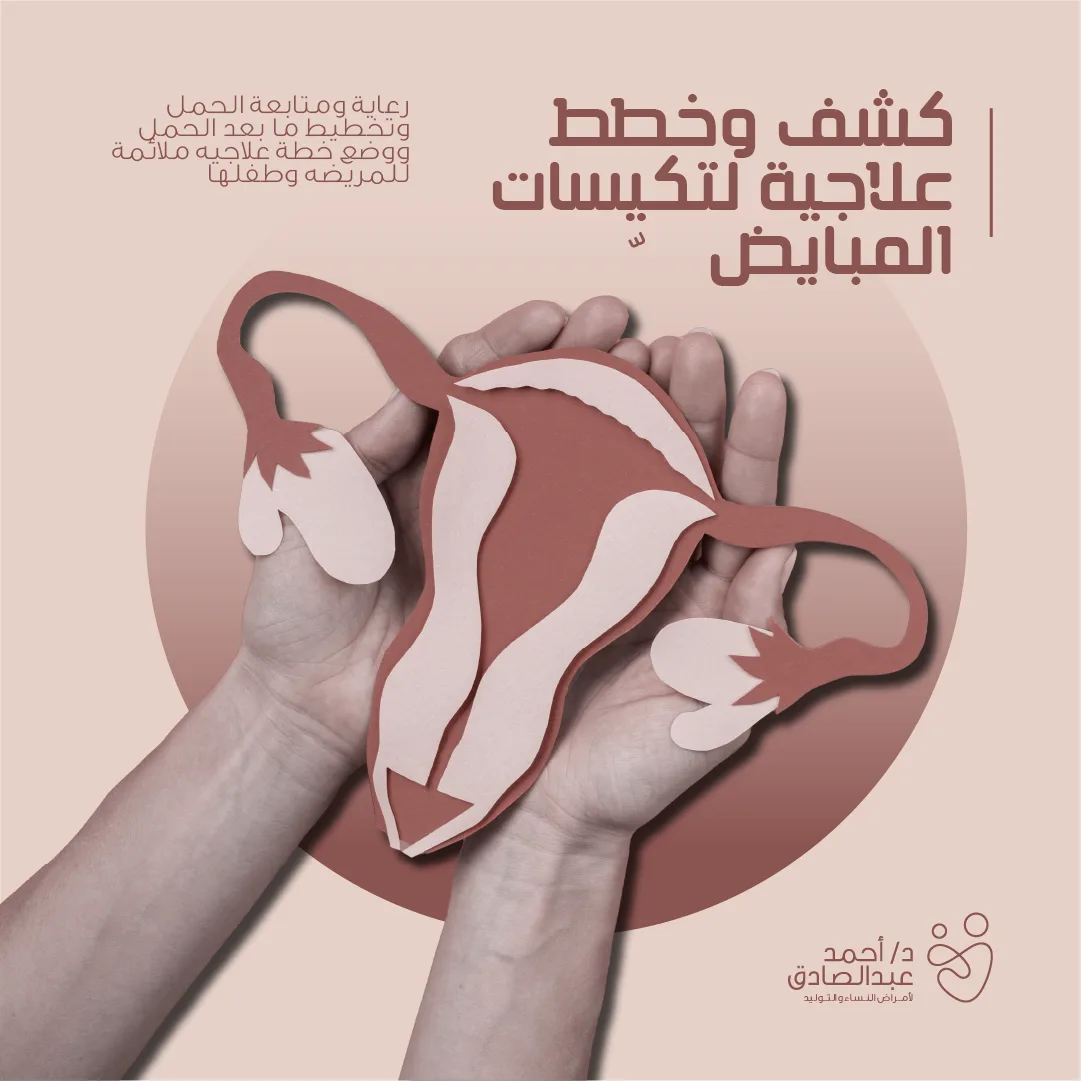 Ovarian cyst diagnosis and treatment plans — a paper-cut uterus held in two hands